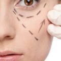 Skin Boosters Explained: The British Perspective on Achieving Radiant and Youthful Skin Without Surgery