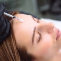 Laser and Light Therapies for Acne Scarring: Availability, Effectiveness, and Cost in the UK