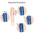 Comprehensive Guide to Treating Red Veins with Light-Based Therapies in the UK