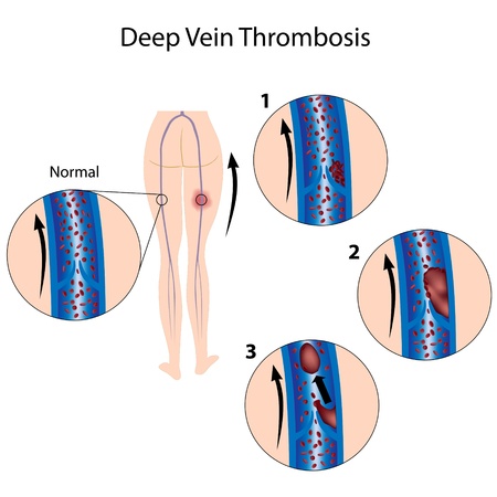 Comprehensive Guide to Treating Red Veins with Light-Based Therapies in the UK