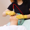 The Patient’s Journey: What to Expect When Getting Laser Therapy for Vascular Lesions