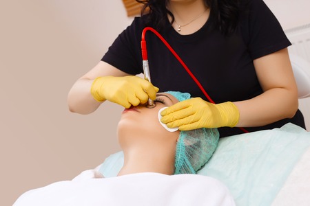 The Patient’s Journey: What to Expect When Getting Laser Therapy for Vascular Lesions