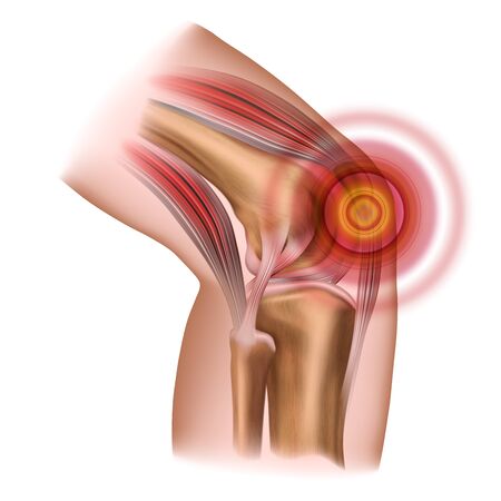 Potential Risks and Complications