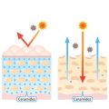 Non-Invasive Collagen Stimulation: The Role of Microneedling and RF in Anti-Ageing