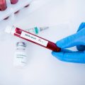 Comparing Injectable Collagen Stimulators: Sculptra, Ellansé and More
