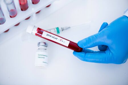 Comparing Injectable Collagen Stimulators: Sculptra, Ellansé and More