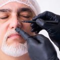 Tattoo Removal Laws and Regulations in the UK: What You Need to Know