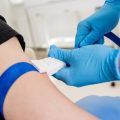 The Evolution of Laser Hair Removal: Historical Perspectives and Modern Innovations in the UK