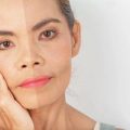 Fractional CO2 Laser Skin Resurfacing: What To Expect Before, During, and After Treatment in the UK