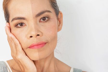 Fractional CO2 Laser Skin Resurfacing: What To Expect Before, During, and After Treatment in the UK