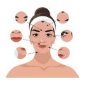 Skin of Colour in the UK: Unique Challenges in Treating Pigmentation and Melasma