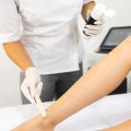 Comparing Fractional and Traditional CO2 Lasers: Which Skin Resurfacing Option Is Best for You?