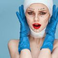Safety Standards and Regulations for Microneedling and Dermarolling in Britain