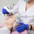 Choosing the Right Clinic: What UK Men Should Know About Laser Beard Shaping