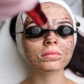 The Evolution of Chemical Peels: What Works Safely for Different Skin Types