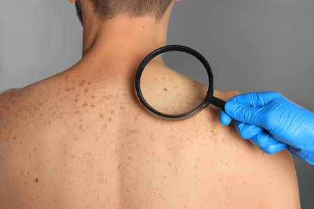The Science Behind Laser Treatments for Vascular Lesions: How Does It Work?