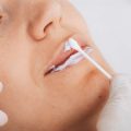 A Comprehensive Guide to Cryolipolysis Eligibility: Who Can Benefit in the UK?