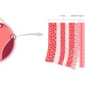 Understanding the Role of Genetics and Lifestyle in Cellulite Formation Among British Women
