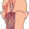 Histological Differences in Ethnic Skin and Their Impact on Laser Treatments