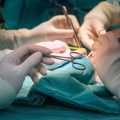 Types of Vascular Lesions: Identification and Laser Treatment Options
