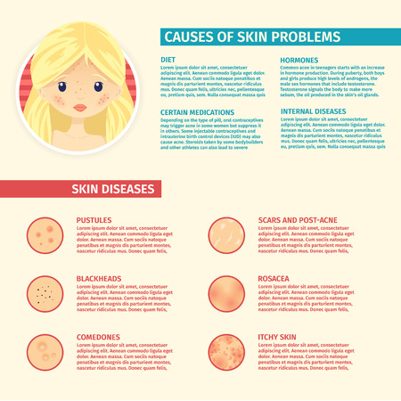 How IPL Treatments Address Pigmentation and Sun Damage for British Skin Types