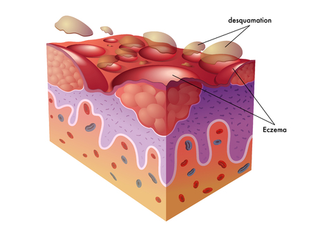 Popular Cellulite Treatments Available in London: Clinics, Trends, and Patient Experiences