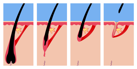 Pigmentation and Its Impact on Health