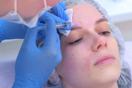 Peels, Micro-needling, and Other Minimally Invasive Skin Rejuvenation Options in Britain