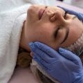The Role of Microneedling in Treating Hyperpigmentation and Sun Damage in the UK