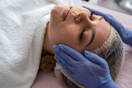The Role of Microneedling in Treating Hyperpigmentation and Sun Damage in the UK