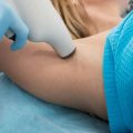 Best Practices in Selecting Laser Parameters for Darker Skin Tones
