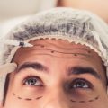 Redefining Beauty Standards: The Role of Genetics in Aesthetic Preferences Across Ethnicities