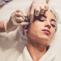 From Millennials to Boomers: Motivations and Trends in Filler Treatments Across Generations in the UK