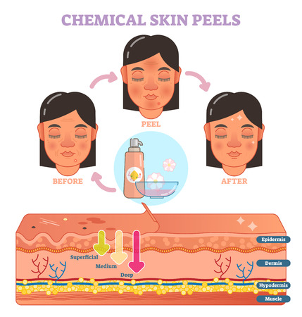 Synergistic Treatments: Enhancing Results by Combining IPL