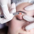 Permanent Results or Temporary Fix? Clarifying the Longevity of Aesthetic Treatments
