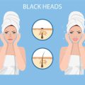 Sensitive Skin in Diverse Ethnicities: Customising Skincare and Treatments