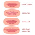 Customising Skincare Regimens for Hyperpigmentation: Insights from British Aesthetic Experts
