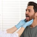 Aftercare Essentials: Post-Laser Beard Shaping Tips for Men in Britain