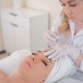 Microneedling for Men: Breaking Taboos in British Skincare