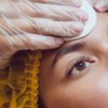 Lifestyle and Environmental Factors Influencing Pigmentation Conditions in the UK
