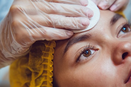 Lifestyle and Environmental Factors Influencing Pigmentation Conditions in the UK