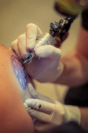 Real Stories: British Clients Share Their Laser Tattoo Removal Experiences