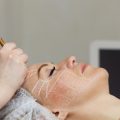 Chemical Peels and British Weather: How Climate Affects Results and Recovery