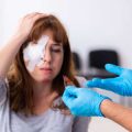 Chemical Peels: The Science vs the Scare Stories