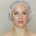 Laser Skin Resurfacing for Acne Scars: How Effective Is Fractional CO2 and What Results Can UK Patients Expect?