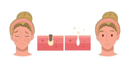 Why Cryolipolysis Appeals to British Men