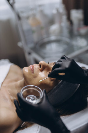 Navigating Over-the-Counter Solutions for Hyperpigmentation: What Works for British Ethnic Skin?