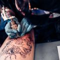 The Future of Laser Tattoo Removal: Trends and Innovations in the British Aesthetic Industry