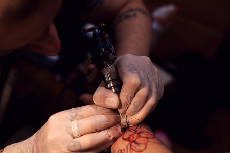 Tattoo Removal for Darker Skin Tones: Risks, Precautions, and Best Practices