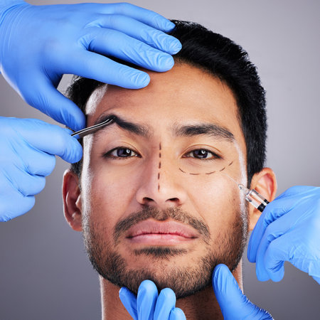 Addressing Unique Male Facial Structure: Customising Injectables for British Men